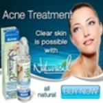 Company Logo of Acne Face Wash Reviews